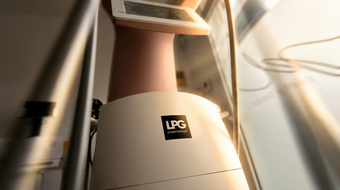 LPG